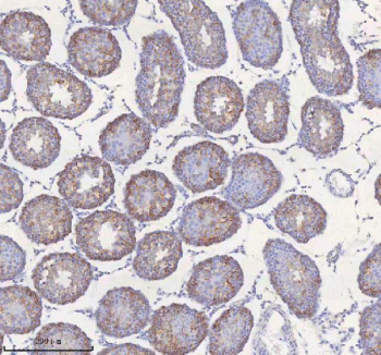 IHC staining of FFPE rat testis tissue with STIM1 antibody. HIER: boil tissue sections in pH8 EDTA for 20 min and allow to cool before testing.