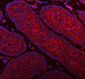 Immunofluorescent staining of FFPE human mouse testis tissue with STIM1 antibody (red) and DAPI nuclear stain (blue). HIER: steam section in pH8 EDTA buffer for 20 min.