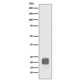 Western blot testing of human NCCIT cell lysate with recombinant CRIPTO antibody. Predicted molecular weight ~21 kDa.