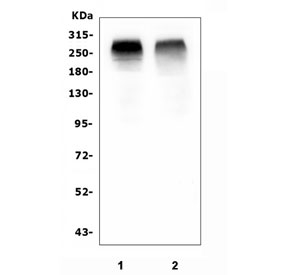 Western blot testing of 1) rat skeletal muscle and 2) mouse skeletal muscle tissue lysate with ACACB antibody. Predicted molecular weight ~277 kDa.