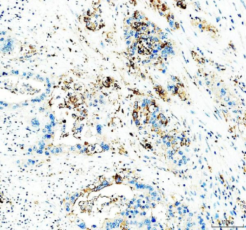 IHC staining of FFPE human appendix tissue with CD24 antibody, HRP-labeled secondary and DAB substrate. HIER: boil tissue sections in pH8 EDTA for 20 min and allow to cool before testing.