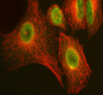 Immunofluorescent staining of FFPE human A549 cells with ARHGEF12 antibody (red) and Beta Tubulin mAb (red). HIER: steam section in pH6 citrate buffer for 20 min.