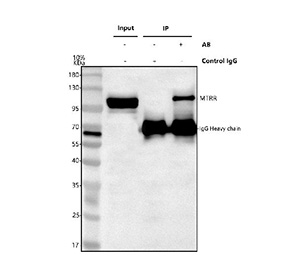 Immunoprecipitation of AqCbl reductase protein from 500ug of human HeLa whole cell lysate with 2ug of AqCbl reductase antibody.