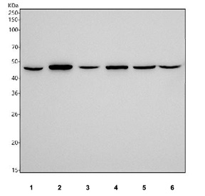 Western blot testing of human 1) K562, 2) A431, 3) HepG2, 4) 293T, 5) PC-3 and 6) SiHa cell lysate with SLC16A1 antibody. Predicted molecular weight ~54 kDa and ~46 kDa (two isoforms).