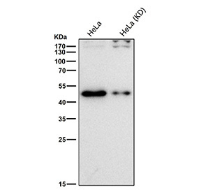 TARDBP Antibody Knockdown WB. Western blot analysis of human HeLa cell lysates from wild-type and TARDBP knockdown cells using TARDBP antibody. A prominent band is detected at approximately 43-45 kDa in wild-type cells with reduced intensity following knockdown, consistent with the predicted and commonly observed molecular weight of TAR DNA-binding protein 43 / TDP-43, an RNA-binding protein involved in RNA processing and neurodegenerative disease pathways.