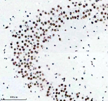 TARDBP Antibody Mouse Brain IHC. Immunohistochemistry analysis of FFPE mouse brain tissue stained with anti-TARDBP antibody. Following heat-induced epitope retrieval in pH 8 EDTA buffer, strong HRP-DAB brown nuclear staining is observed in neuronal cell populations, consistent with the known nuclear localization of TAR DNA-binding protein 43 / TDP-43, an RNA-binding protein involved in RNA splicing, stress granule biology, and neurodegeneration-associated RNA processing pathways.