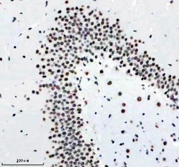 TARDBP Antibody Rat Brain IHC. Immunohistochemistry analysis of FFPE rat brain tissue stained with anti-TARDBP antibody. Following heat-induced epitope retrieval in pH 8 EDTA buffer, widespread HRP-DAB brown nuclear staining is observed in neuronal cell populations, consistent with expression of TAR DNA-binding protein 43 / TDP-43, a neuronal RNA-binding protein involved in RNA metabolism, stress-responsive ribonucleoprotein regulation, and neurodegeneration-associated signaling pathways.