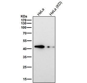 TAR DNA binding protein 43 Antibody Knockdown WB. Western blot testing of human HeLa cell lysate (wild type and knock down) with TAR DNA binding protein 43 antibody. Predicted molecular weight ~45 kDa, commonly observed at 43-45 kDa.