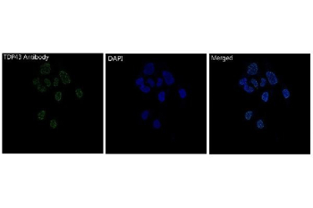 TAR DNA binding protein 43 Antibody IF. Immunofluorescent staining of FFPE human HeLa cells with TAR DNA binding protein 43 antibody (green) and DAPI nuclear stain (blue). HIER: steam section in pH6 citrate buffer for 20 min.