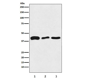 TAR DNA binding protein 43 Antibody HeLa and Brain WB. Western blot testing of 1) human HeLa, 2) mouse brain and 3) rat brain tissue lysate with TAR DNA binding protein 43 antibody. Predicted molecular weight ~45 kDa, commonly observed at 43-45 kDa.