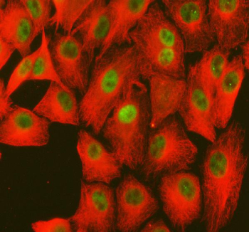 Immunofluorescent staining of FFPE human A549 cells with ME1 antibody (green) and Alpha Tubulin mAb (red). HIER: steam section in pH6 citrate buffer for 20 min.