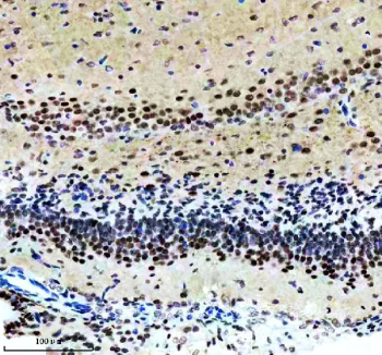 IHC staining of FFPE mouse brain tissue with Alpha-Synuclein antibody, HRP-secondary and DAB substrate. HIER: boil tissue sections in pH8 EDTA for 20 min and allow to cool before testing.
