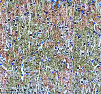 IHC staining of FFPE rat brain tissue with Alpha-Synuclein antibody, HRP-secondary and DAB substrate. HIER: boil tissue sections in pH8 EDTA for 20 min and allow to cool before testing.