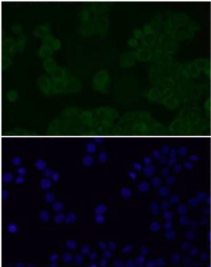 Immunofluorescent staining of FFPE human HeLa cells with Alpha-Synuclein antibody (green) and DAPI nuclear stain (blue). HIER: steam section in pH6 citrate buffer for 20 min.