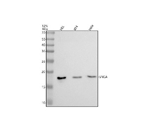 Western blot testing of human 1) HEL, 2) RT4 and 3) HeLa cell lysate with Alpha-Synuclein antibody. Predicted molecular weight ~15 kDa.