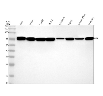 Western blot testing of 1) human HeLa, 2) human Jurkat, 3) human HepG2, 4) human MCF7, 5) rat spleen, 6) rat PC-12, 7) mouse spleen and 8) mouse RAW264.7 cell lysate with IL7RA antibody. Predicted molecular weight ~52kDa but can be observed at higher molecular weights due to glycosylation.