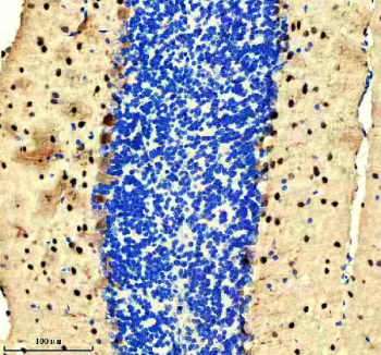IHC staining of FFPE mouse cerebellum tissue with PVALB antibody, HRP-secondary and DAB substrate. HIER: boil tissue sections in pH8 EDTA for 20 min and allow to cool before testing.