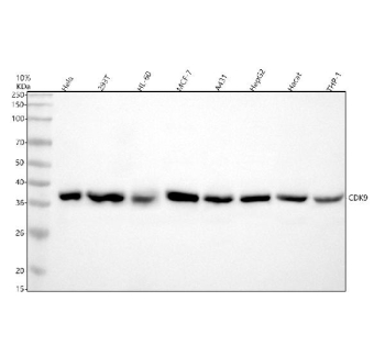 Western blot testing of human 1) HeLa, 2) 293T, 3) HL60, 4) MCF7, 5) A431, 6) HepG2, 7) HaCaT and 8) ThP-1 cell lysate with Cyclin dependent kinase 9 antibody. Predicted molecular weight ~43 kDa.