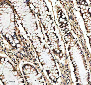 IHC staining of FFPE human colon tissue with SHP2 antibody, HRP-secondary and DAB substrate. HIER: boil tissue sections in pH8 EDTA for 20 min and allow to cool before testing.