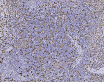 AIF-1 Antibody Rabbit Monoclonal Tonsil IHC. Immunohistochemistry of AIF-1 Antibody Rabbit Monoclonal clone AFGH-1 in human tonsil tissue. Formalin-fixed, paraffin-embedded tonsil demonstrates cytoplasmic HRP-DAB brown staining in scattered immune cells within the lymphoid parenchyma, consistent with Allograft inflammatory factor 1 expression in macrophages and activated immune cells. Heat-induced epitope retrieval was performed by boiling tissue sections in pH 8 EDTA for 20 minutes followed by cooling prior to staining. The rabbit monoclonal antibody clone AFGH-1 was used as the primary antibody, with HRP-conjugated secondary antibody and DAB substrate for chromogenic detection.