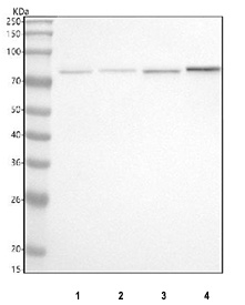 Western blot testing of 1) human RT4, 2) rat brain, 3) rat lung and 4) mouse lung tissue lysate with PRKCH antibody. Predicted molecular weight ~78 kDa.