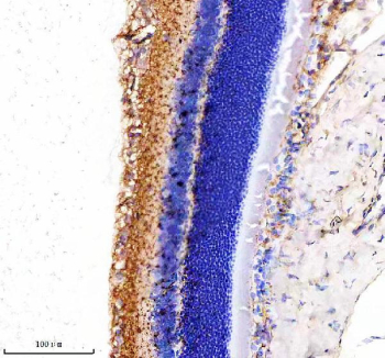 IHC staining of FFPE rat eye tissue with MYO7A antibody, HRP-secondary and DAB substrate. HIER: boil tissue sections in pH8 EDTA for 20 min and allow to cool before testing.