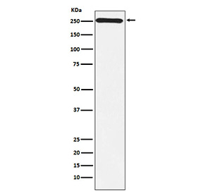 Western blot testing of human Y79 cell lysate with MYO7A antibody. Predicted molecular weight ~254 kDa.