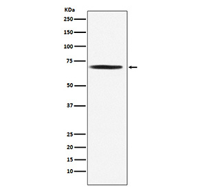 Western blot testing of human Jurkat cell lysate with PDC-E2 antibody. Predicted molecular weight ~69 kDa.