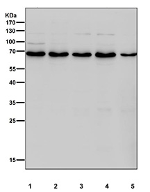 Western blot testing of human 1) HeLa, 2) Jurkat, 3) HepG2, 4) MCF7 and 5) SH-SY5Y cell lysate with PDC-E2 antibody. Predicted molecular weight ~69 kDa.