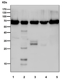 Western blot testing of human 1) HEK293, 2) ThP-1, 3) A431, 4) SH-SY5Y and 5) A673 cell lysate with PDC-E2 antibody. Predicted molecular weight ~69 kDa.
