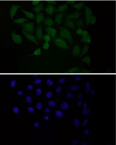 Immunofluorescent staining of FFPE human HeLa cells with PDC-E2 antibody (green) and DAPI nuclear stain (blue). HIER: steam section in pH6 citrate buffer for 20 min.