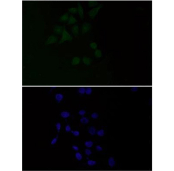 Immunofluorescent staining of FFPE human HeLa cells with PDC-E2 antibody (green) and DAPI nuclear stain (blue). HIER: steam section in pH6 citrate buffer for 20 min.