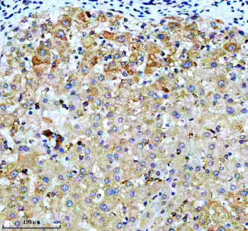 IHC staining of FFPE human liver tissue with VASP antibody, HRP-secondary and DAB substrate. HIER: boil tissue sections in pH8 EDTA for 20 min and allow to cool before testing.