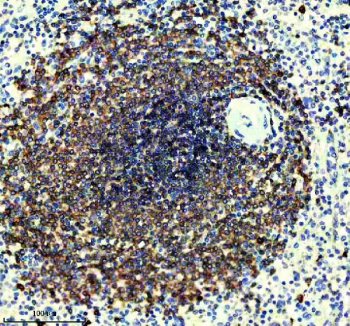 CD22 Antibody Spleen Tissue IHC Staining. Immunohistochemistry analysis of CD22/Siglec-2 expression in FFPE human spleen tissue using CD22 Antibody / B Cell Internalization and Targeting Antibody. HRP-DAB brown staining is concentrated within lymphoid follicles of the white pulp, highlighting dense populations of B lymphocytes with prominent membranous and cytoplasmic localization, while surrounding red pulp regions and non-lymphoid elements remain largely negative. The staining pattern is consistent with CD22 surface expression and its role in receptor internalization and cellular targeting within B cell compartments. Detection was performed using an HRP-conjugated secondary antibody with DAB substrate. Heat-induced epitope retrieval was carried out in pH 8 EDTA buffer for 20 minutes followed by cooling prior to antibody incubation.