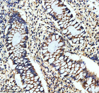 IHC staining of FFPE human colon tissue with CHMP2B antibody, HRP-secondary and DAB substrate. HIER: boil tissue sections in pH8 EDTA for 20 min and allow to cool before testing.