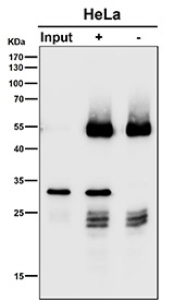 Immunoprecipitation of CHMP2B protein from 500ug of human HeLa whole cell lysate using CHMP2B antibody at 1:50 (Western blot testing done at 1:3000).