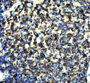 IHC staining of FFPE rat thymus tissue with CD247 antibody, HRP-secondary and DAB substrate. HIER: boil tissue sections in pH8 EDTA for 20 min and allow to cool before testing.