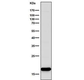 Western blot testing of human Jurkat cell lysate with CD247 antibody. Predicted molecular weight ~19 kDa but may be observed at higher molecular weights due to glycosylation.