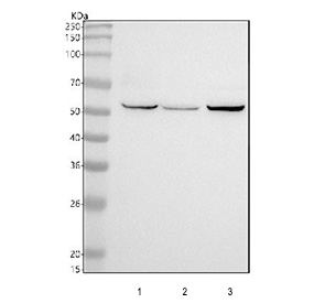Western blot testing of human 1) HeLa, 2) HepG2 and 3) A549 cell lysate with CAMK2 antibody. Predicted molecular weight ~54 kDa.