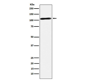 Western blot testing of human fetal brain tissue lysate with RAPGEF4 antibody. Predicted molecular weight ~115 kDa.