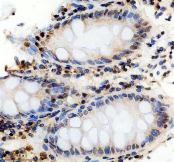 IHC staining of FFPE human colon tissue with PHF8 antibody, HRP-secondary and DAB substrate. HIER: boil tissue sections in pH8 EDTA for 20 min and allow to cool before testing.