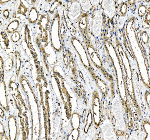 SMC4 Antibody staining of human kidney by IHC. Immunohistochemistry of FFPE human kidney sections using the SMC4 Antibody at 2 ug/ml. Brown staining is visible in subsets of renal tubular epithelial cells, with signal present in both nuclear and cytoplasmic compartments and variation in intensity among individual tubules. Glomerular and interstitial regions show comparatively limited staining, while nuclei are counterstained blue. Heat-mediated antigen retrieval was performed in pH 8 EDTA before antibody incubation. The observed tissue staining demonstrates detection of structural maintenance of chromosomes protein 4 with this CAP-C Antibody.