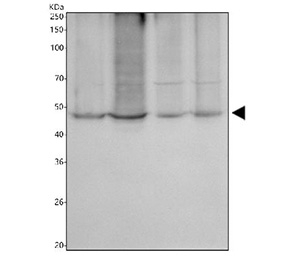 DGAT1 Antibody Human Cell Lysates WB. Western blot analysis of DGAT1 expression was performed using anti-DGAT1 antibody in lysates from HeLa, PC-3, HepG2, and Caco-2 cells. DGAT1, also known as Diacylglycerol O-Acyltransferase 1, catalyzes the final step of triglyceride synthesis and plays a critical role in lipid storage and energy homeostasis. A specific immunoreactive band is detected at approximately 45-55 kDa in all four cell lines, consistent with the predicted molecular weight of DGAT1 (~55 kDa). Similar expression across cervical, prostate, liver, and intestinal cell lines reflects the widespread requirement for triglyceride biosynthesis and lipid droplet formation in diverse cell types. These results support the utility of DGAT1 Antibody for studies of lipid metabolism, energy homeostasis, and metabolic disease.