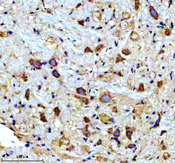 IHC staining of FFPE rat brain tissue with CAMK II alpha antibody, HRP-secondary and DAB substrate. HIER: boil tissue sections in pH8 EDTA for 20 min and allow to cool before testing.