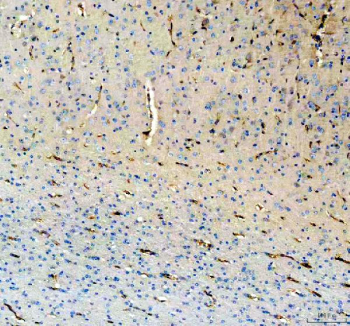IHC staining of FFPE pig brain tissue with NES antibody, HRP-secondary and DAB substrate. HIER: boil tissue sections in pH8 EDTA for 20 min and allow to cool before testing.