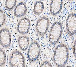 IHC staining of FFPE human colon tissue with DEAD box protein 1 antibody, HRP-secondary and DAB substrate. HIER: boil tissue sections in pH8 EDTA for 20 min and allow to cool before testing.