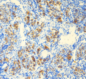 IHC staining of FFPE mouse ovary tissue with DEAD box protein 1 antibody, HRP-secondary and DAB substrate. HIER: boil tissue sections in pH8 EDTA for 20 min and allow to cool before testing.