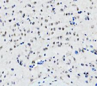 IHC staining of FFPE mouse brain tissue with DEAD box protein 1 antibody, HRP-secondary and DAB substrate. HIER: boil tissue sections in pH8 EDTA for 20 min and allow to cool before testing.