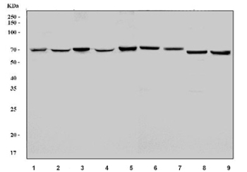 Western blot testing of 1) human Raji, 2) human HeLa, 3) human HEK293, 4) human HepG2, 5) human K562, 6) rat liver, 7) rat pancreas, 8) mouse liver and 9) mouse pancreas tissue lysate with CBS antibody. Predicted molecular weight ~61 kDa.