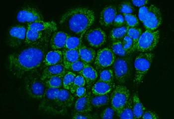 Immunofluorescent staining of FFPE human A431 cells with GLRX antibody (green) and DAPI nuclear stain (blue). HIER: steam section in pH6 citrate buffer for 20 min.